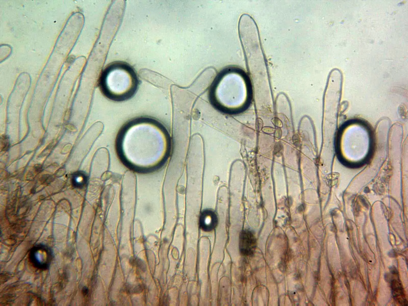 Microscopía de Lepiota brunneoincarnata - 10 - Suprapellis 3